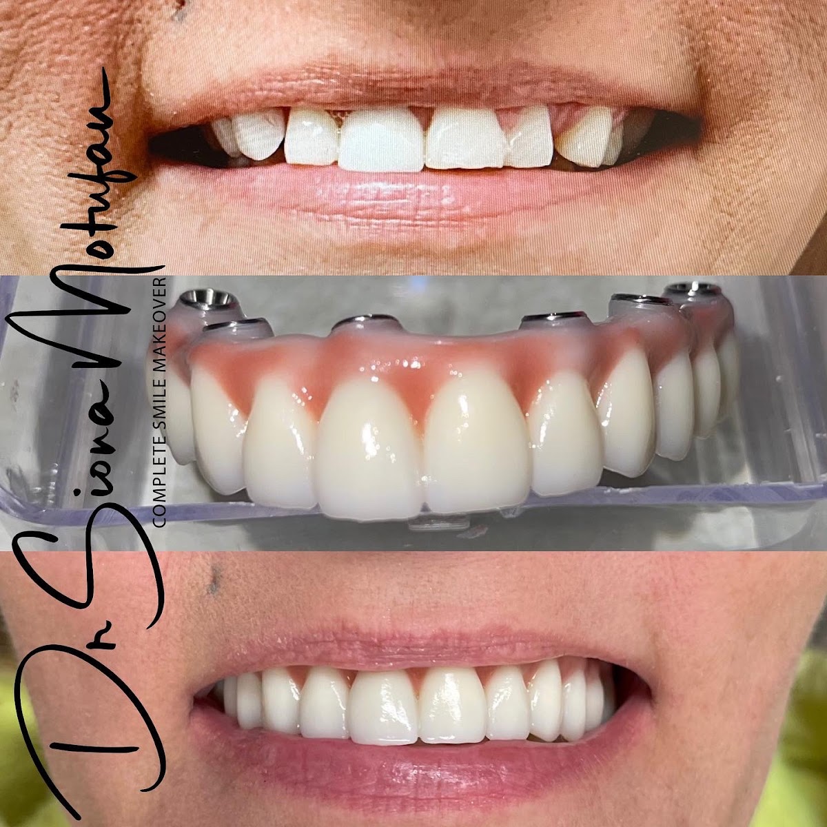 Ohana Dental Implant Centers photo 3