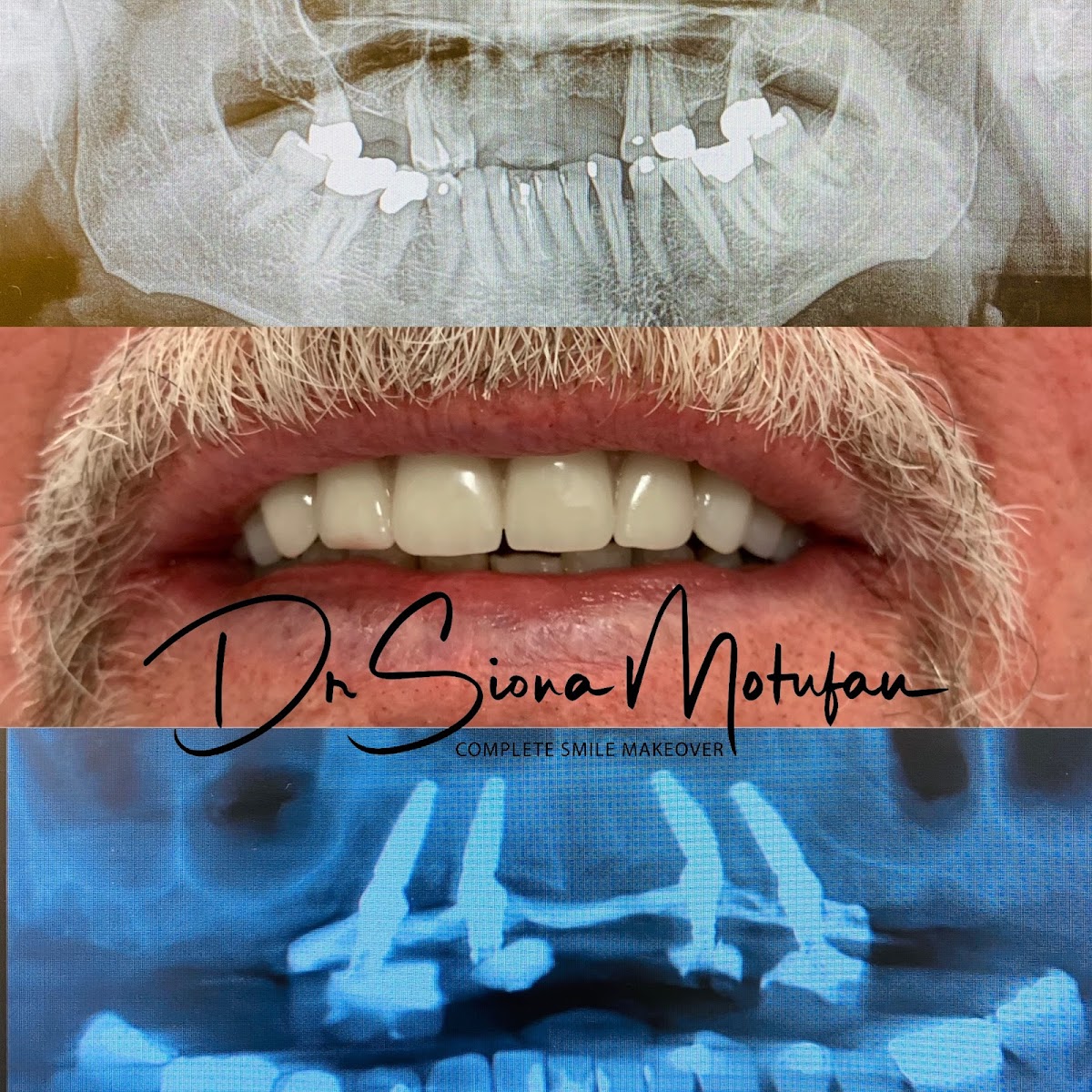 Ohana Dental Implant Centers photo 5
