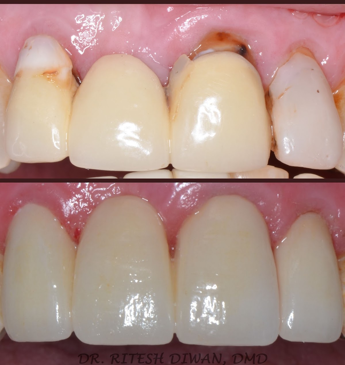 Smiles 4u Dental photo 5