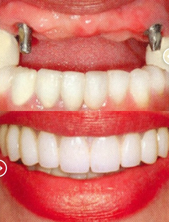 Boca Perio Implants: Dr. Julian C. Leichter, DMD photo 1