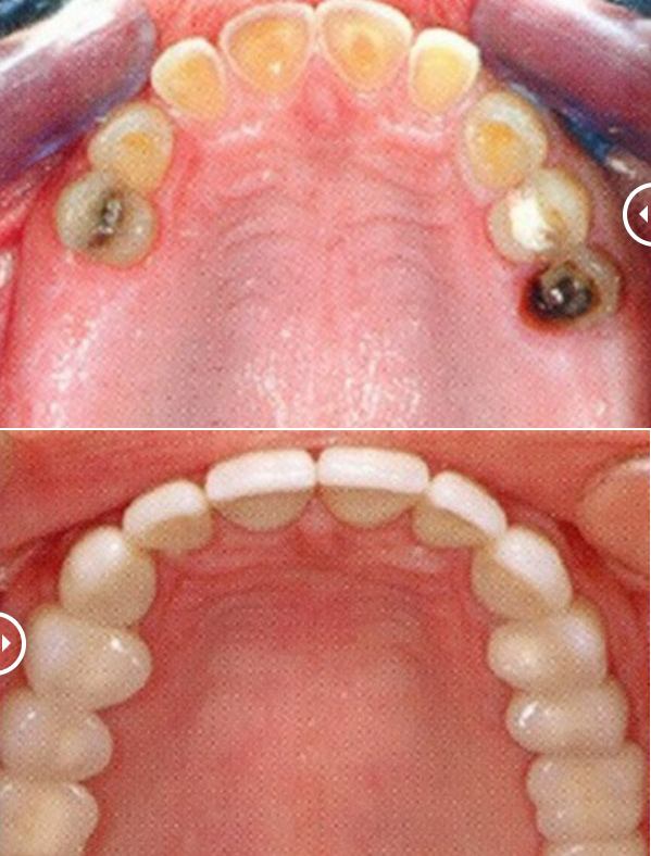 Boca Perio Implants: Dr. Julian C. Leichter, DMD photo 2