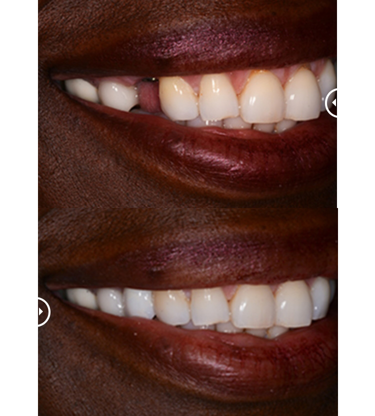 Boca Perio Implants: Dr. Julian C. Leichter, DMD photo 3