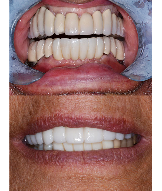 Boca Perio Implants: Dr. Julian C. Leichter, DMD photo 4