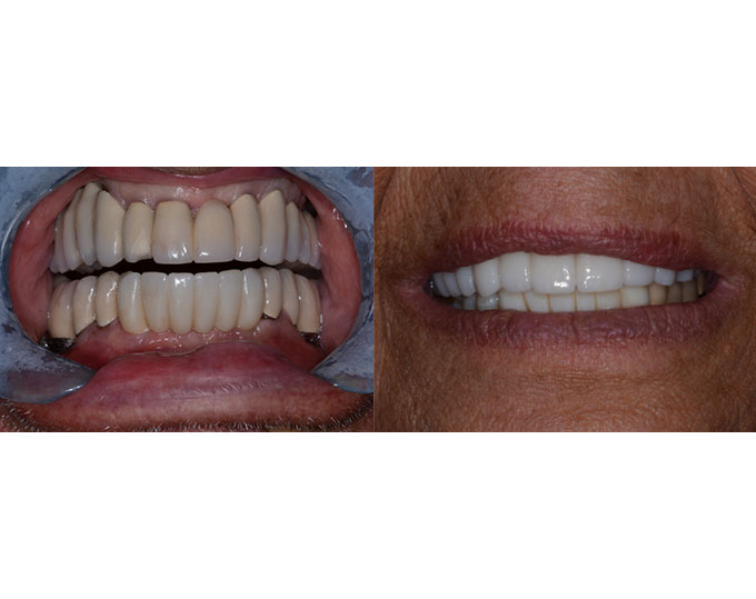 Boca Perio Implants: Dr. Julian C. Leichter, DMD photo 5