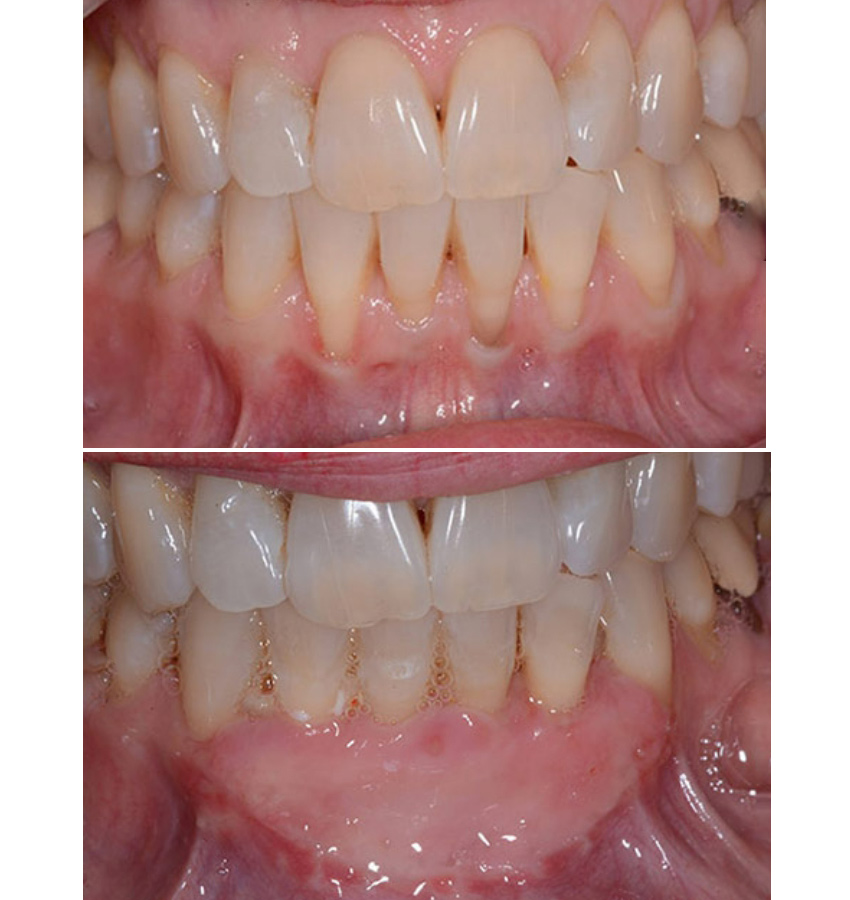 Boca Perio Implants: Dr. Julian C. Leichter, DMD photo 6