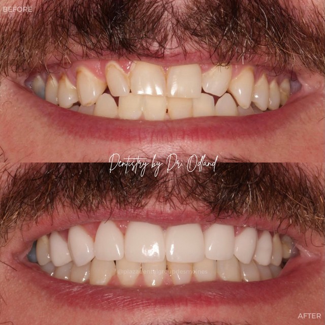 Plaza Dental Group, West Des Moines photo 1