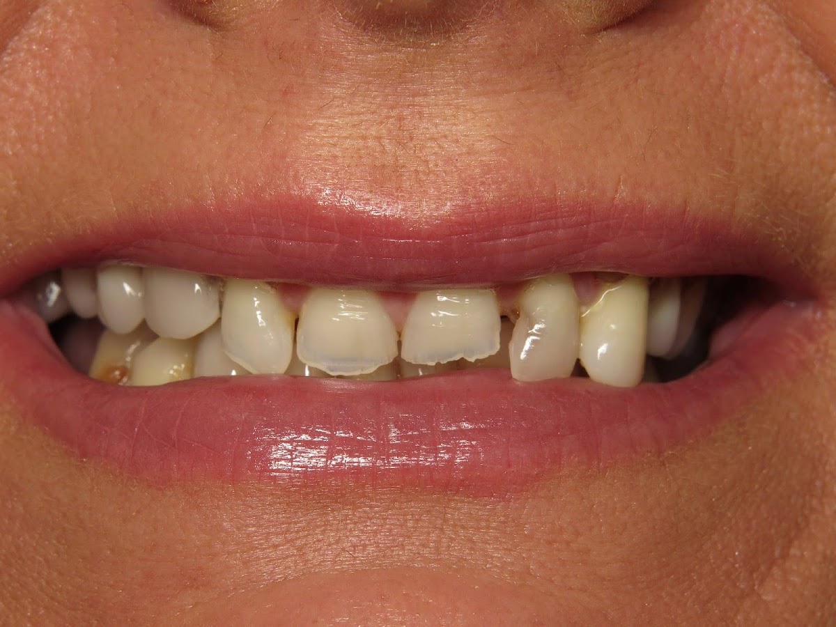All-in-one Dental photo 1