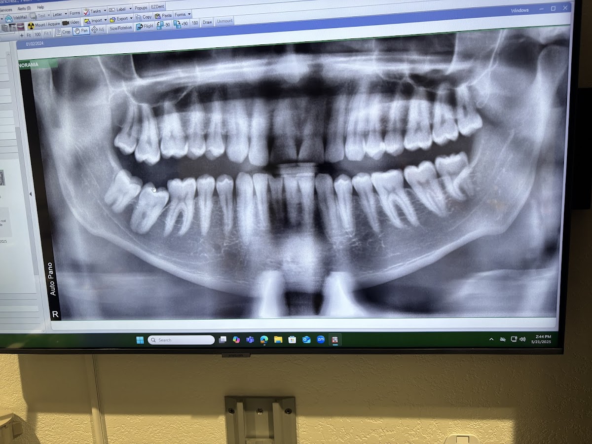 Omssc, Wisdom Teeth Removal & Sedation, Dr. Ali Board-Certified Oral Surgeon photo 2