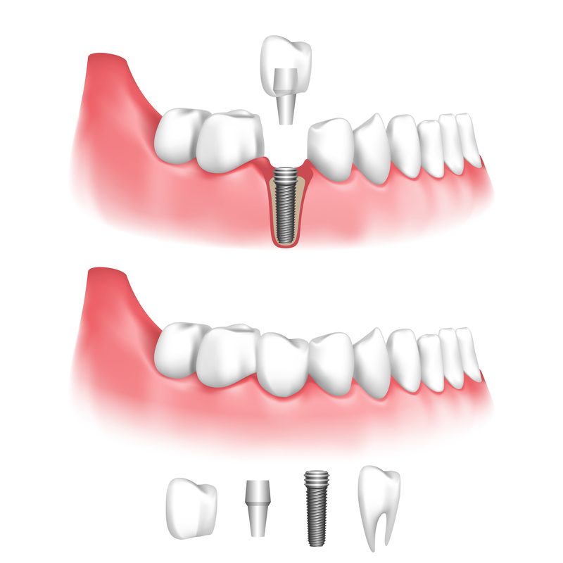 Prestige Oral Surgery photo 2