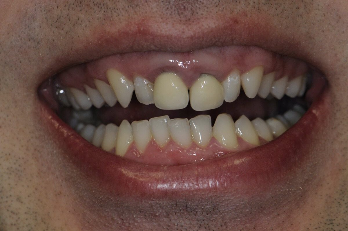 Comfort Care Dental Rexburg photo 3