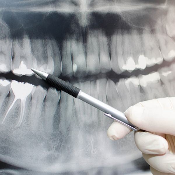 Comfort Care Dental Rexburg photo 5