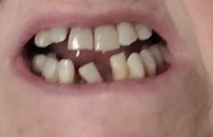 Affordable Dentures & Implants - Kennesaw photo 6