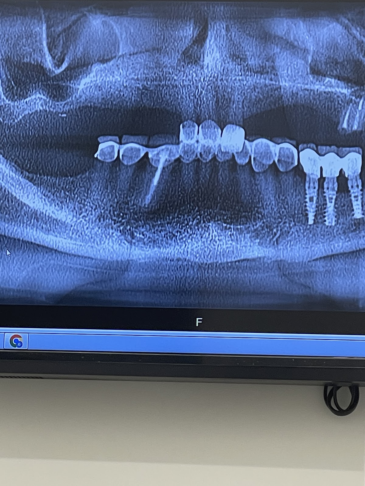 Global Implant Dentistry photo 1