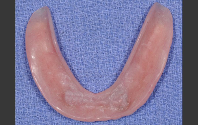 Dentkits photo 2