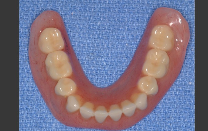 Dentkits photo 3