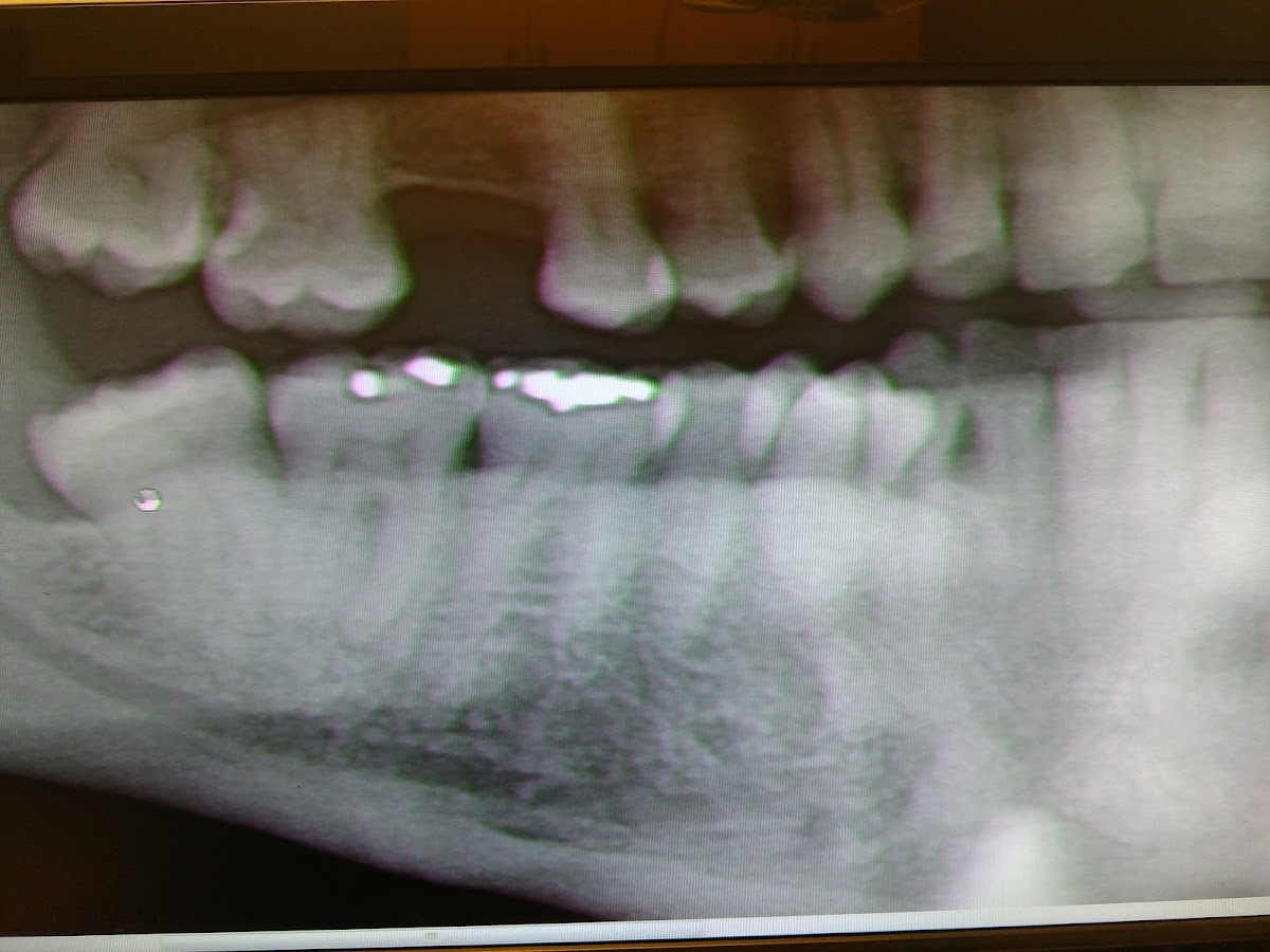 Aspen Dental - Okemos photo 6