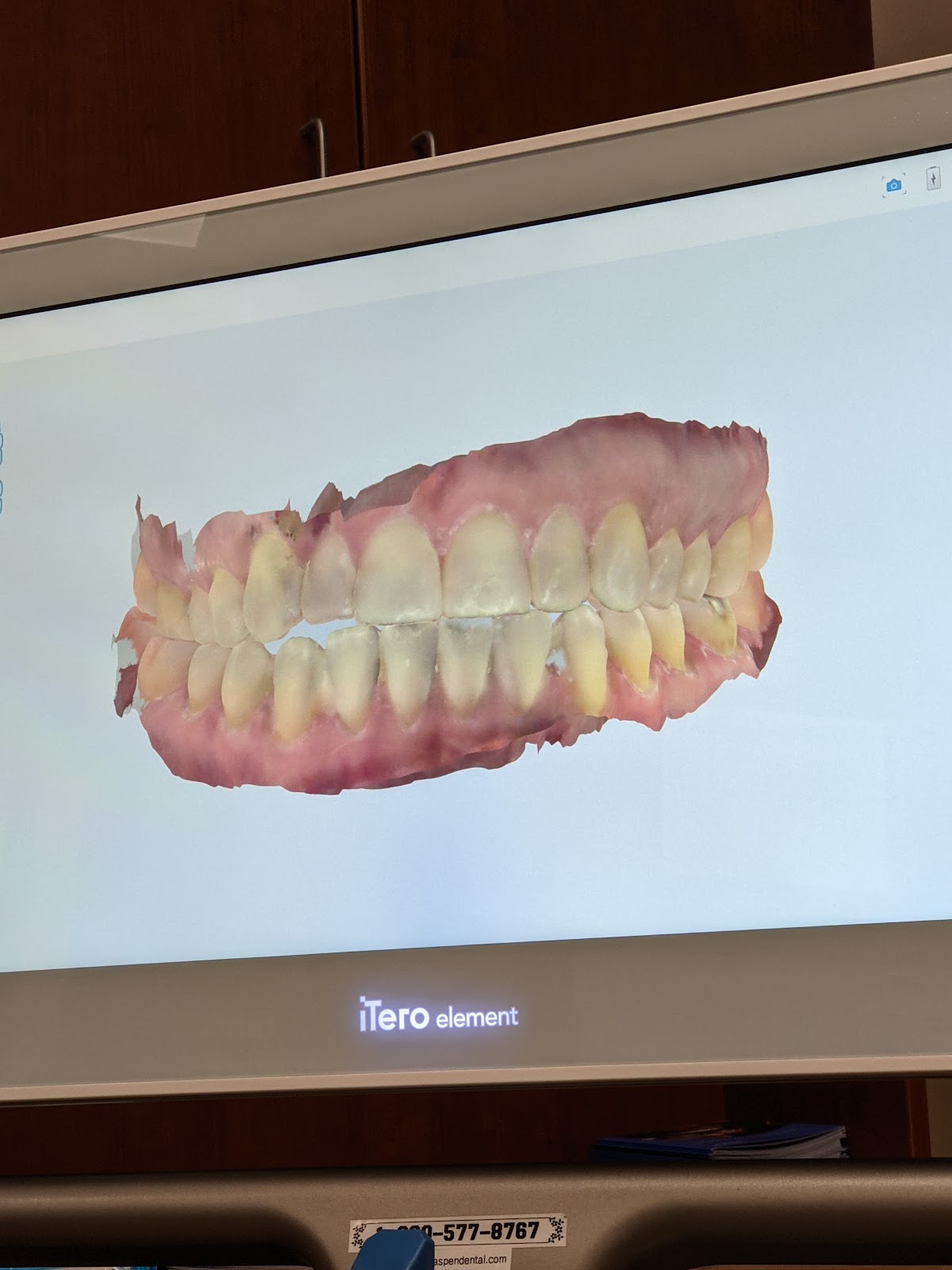 Aspen Dental - Morristown photo 4