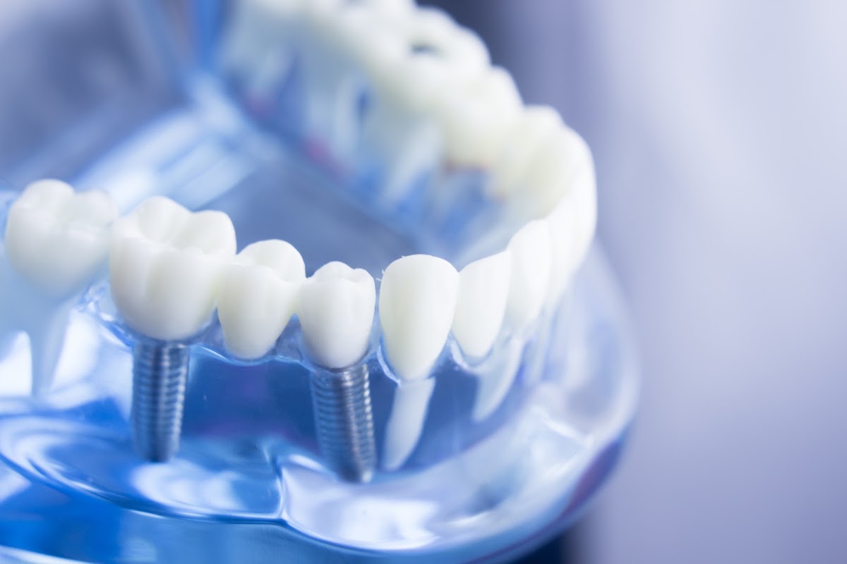 Vip Family & Sedation Dentistry photo 1