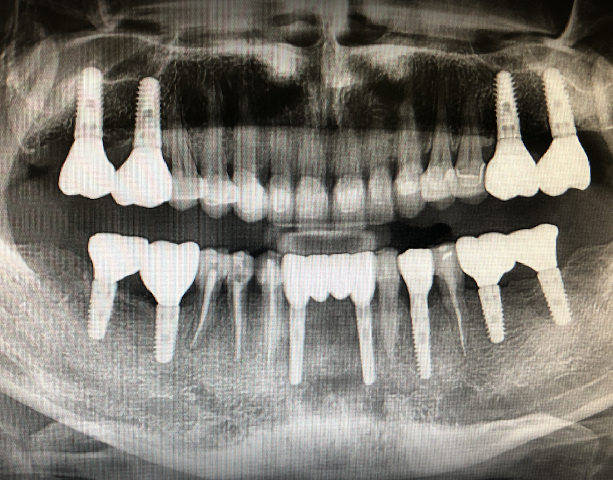 Implantology Seminars photo 4