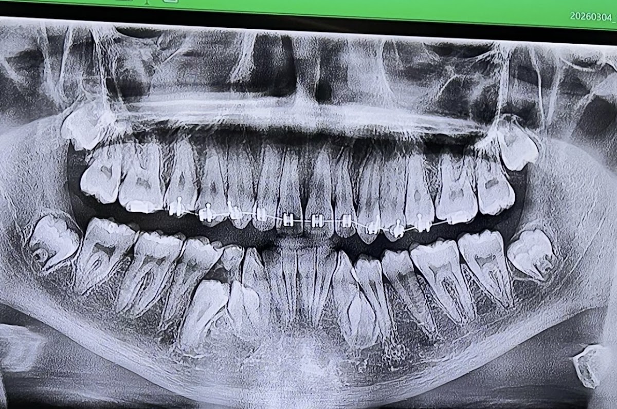 Dfw Oral & Maxillofacial Surgery photo 3