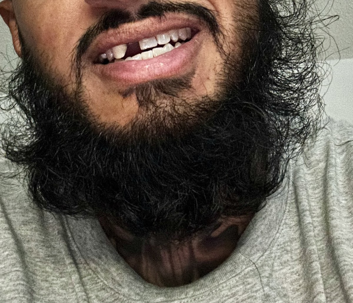 Affordable Dentures & Implants - Kissimmee photo 5