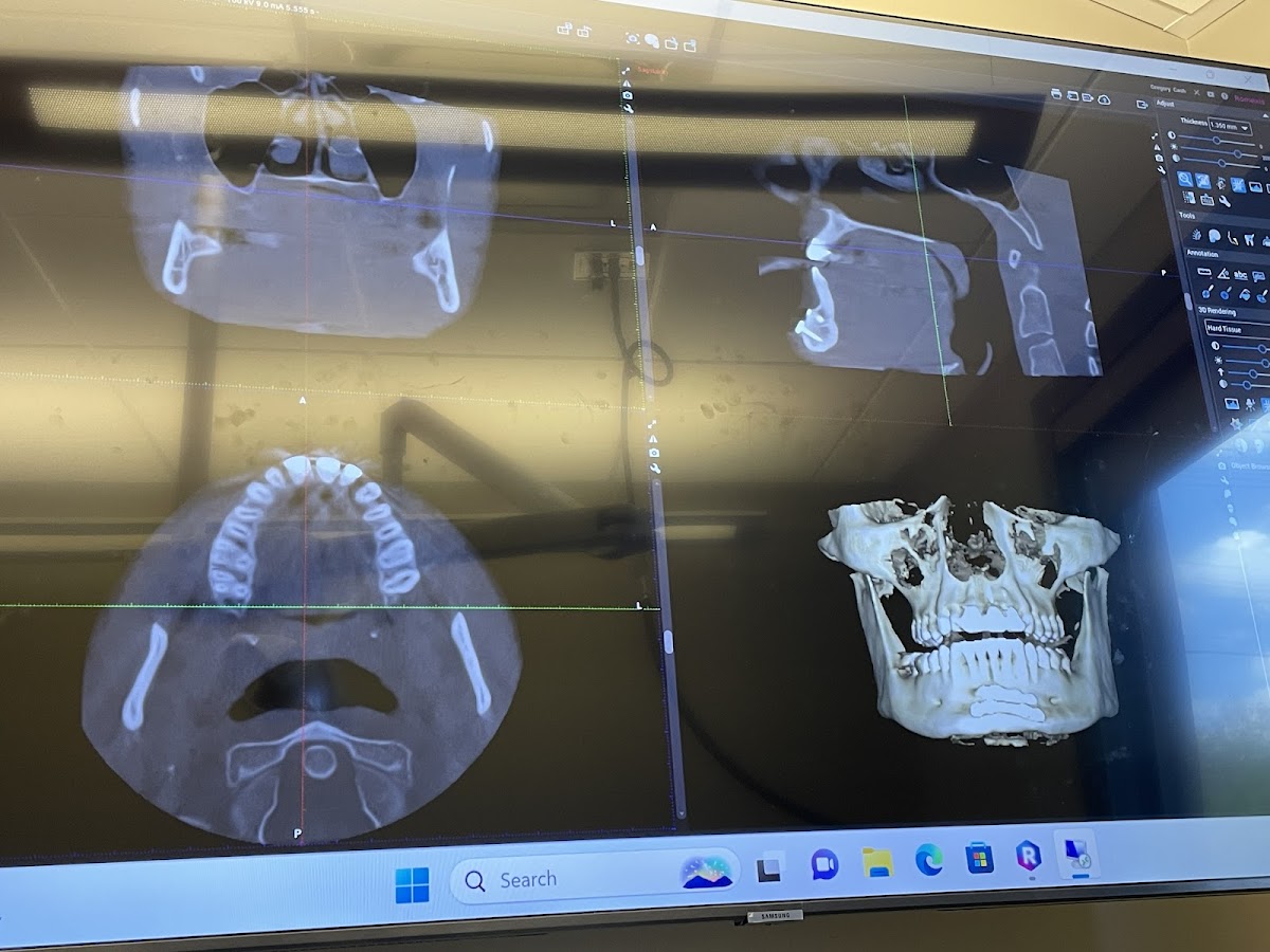 Aspire Surgical photo 5
