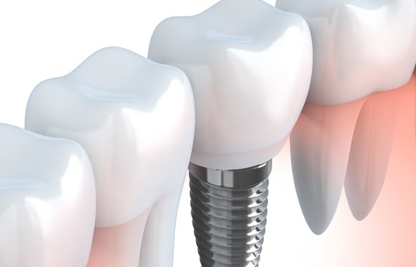 Anacapa Oral Surgery photo 6