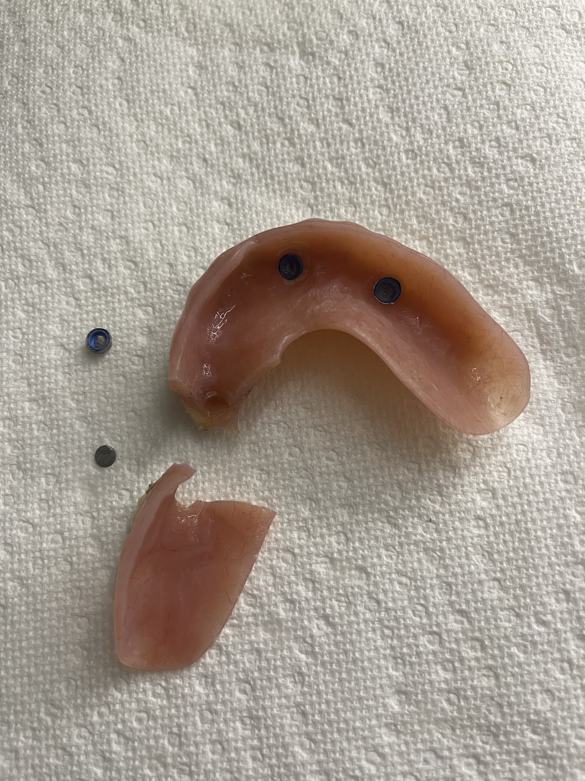 Aspen Dental - Saint Peters photo 6