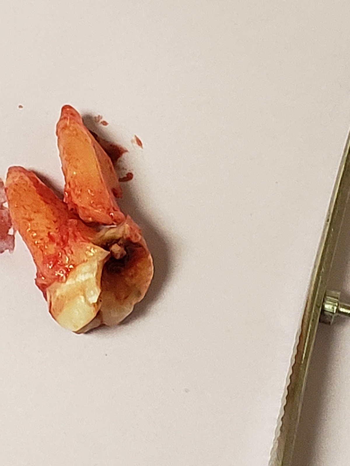 Aspen Dental - Cleveland photo 6