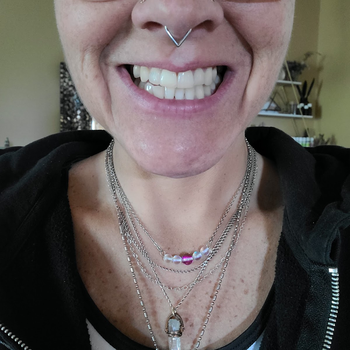 Four Corners Dental and Dentures photo 4