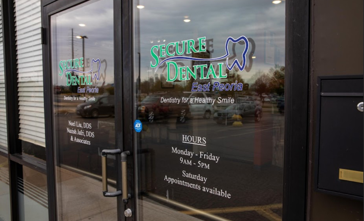 Secure Dental photo 5