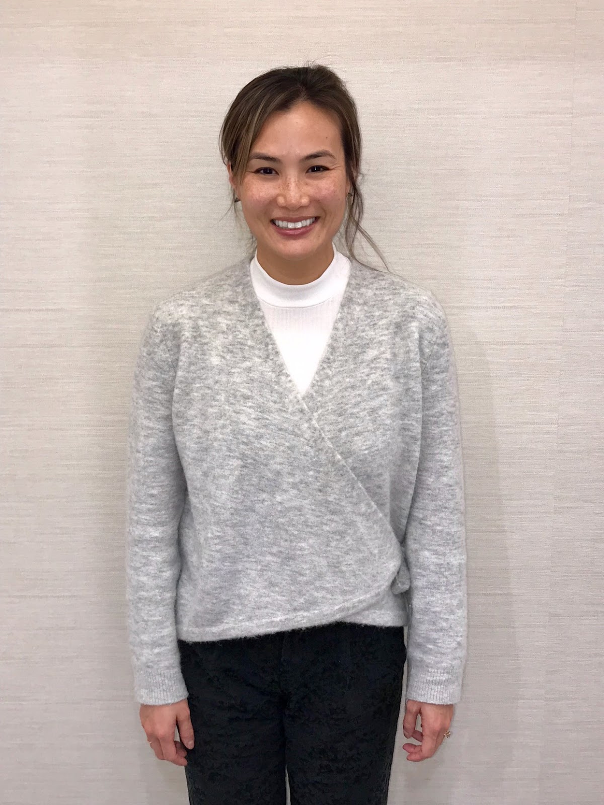 All on Four Dental Implants New Jersey photo 4