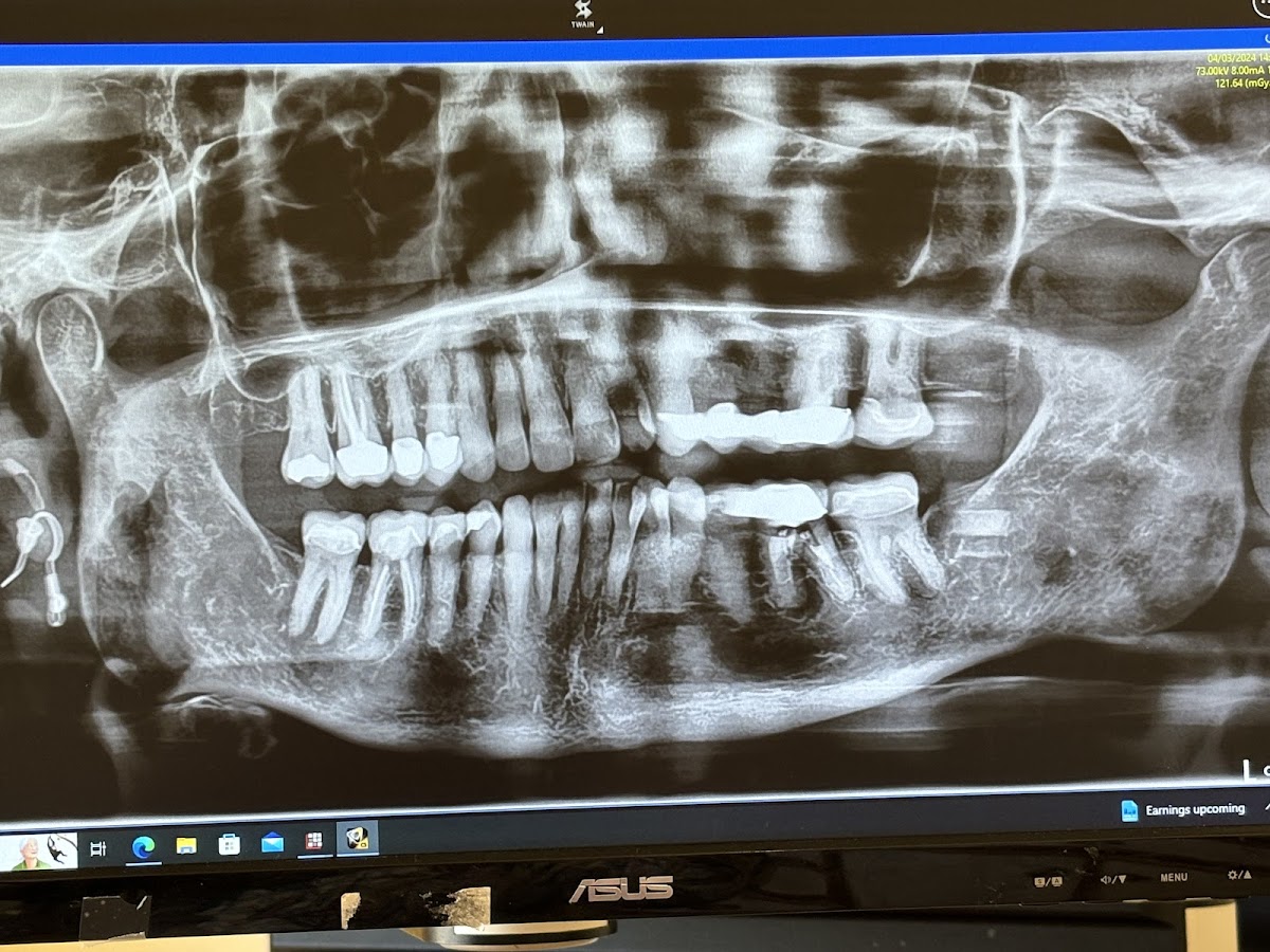 Valley Implants and Oral Surgery | Dr. Travis Sorensen D.D.S. photo 5