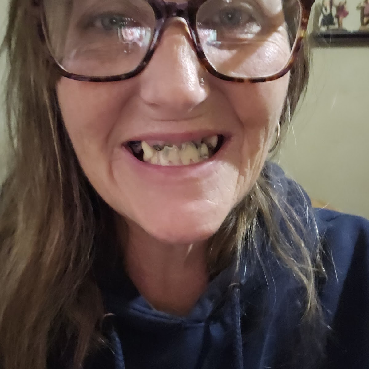 Innovative Smiles: Collins and Associates, DDS, PA photo 3