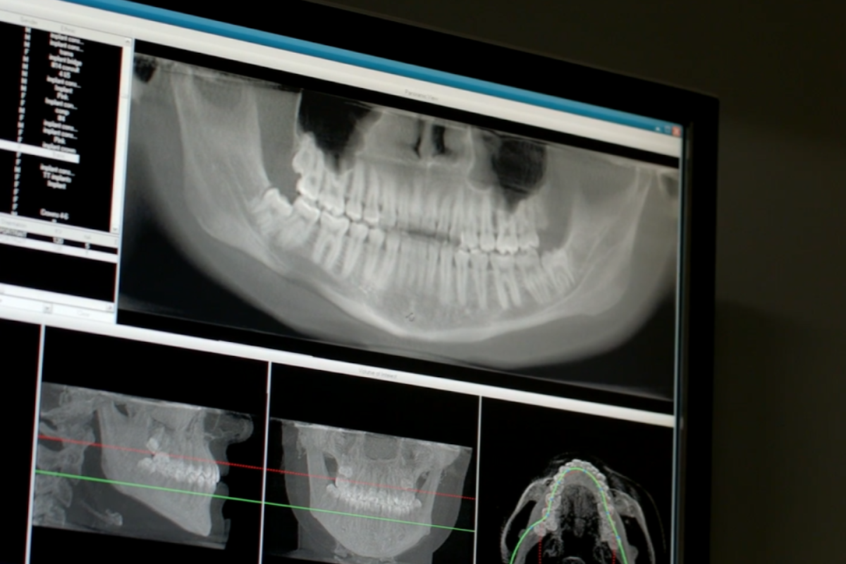 Robertsdale Dental Implants photo 6