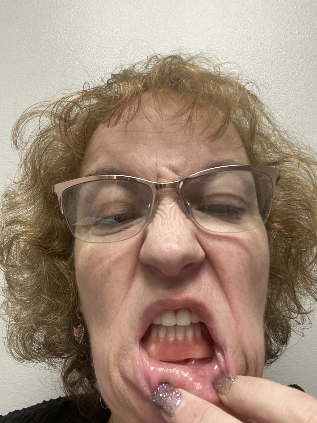Affordable Dentures & Implants - Towson photo 6
