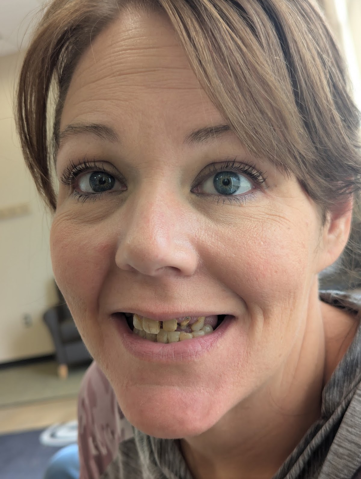 Aspen Dental - Bemidji photo 5