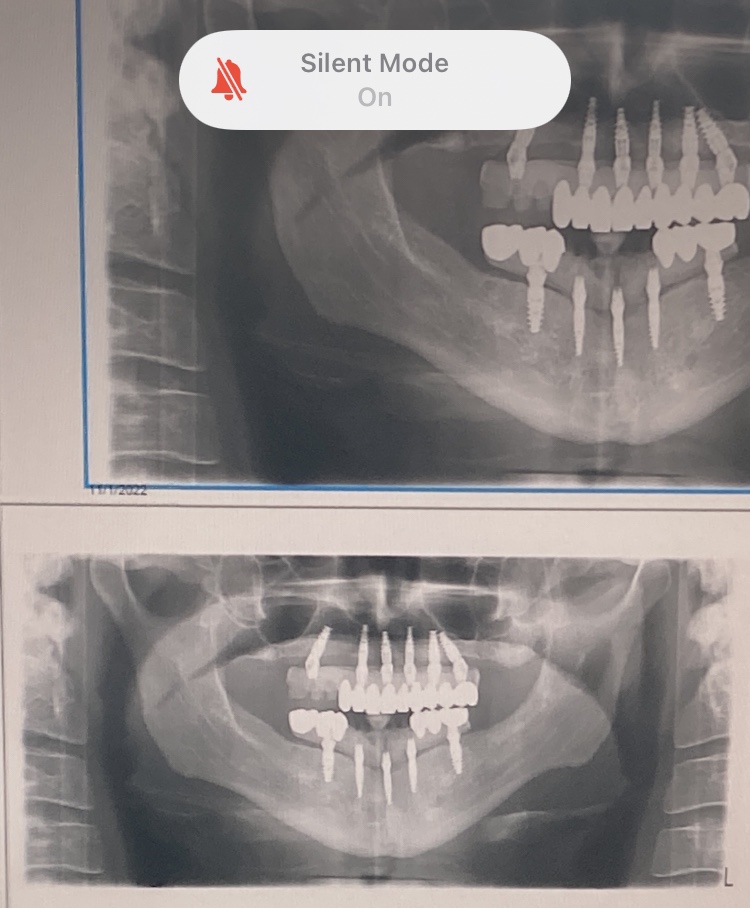 Holden Periodontics and Dental Implants photo 1