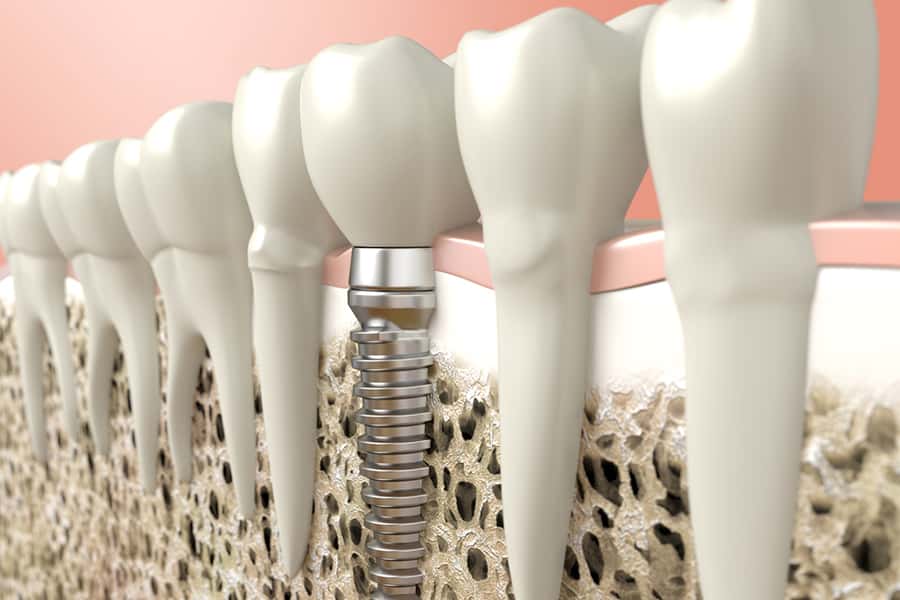 Innovative Periodontics & Implants: Donald G Flynn, DDS photo 5