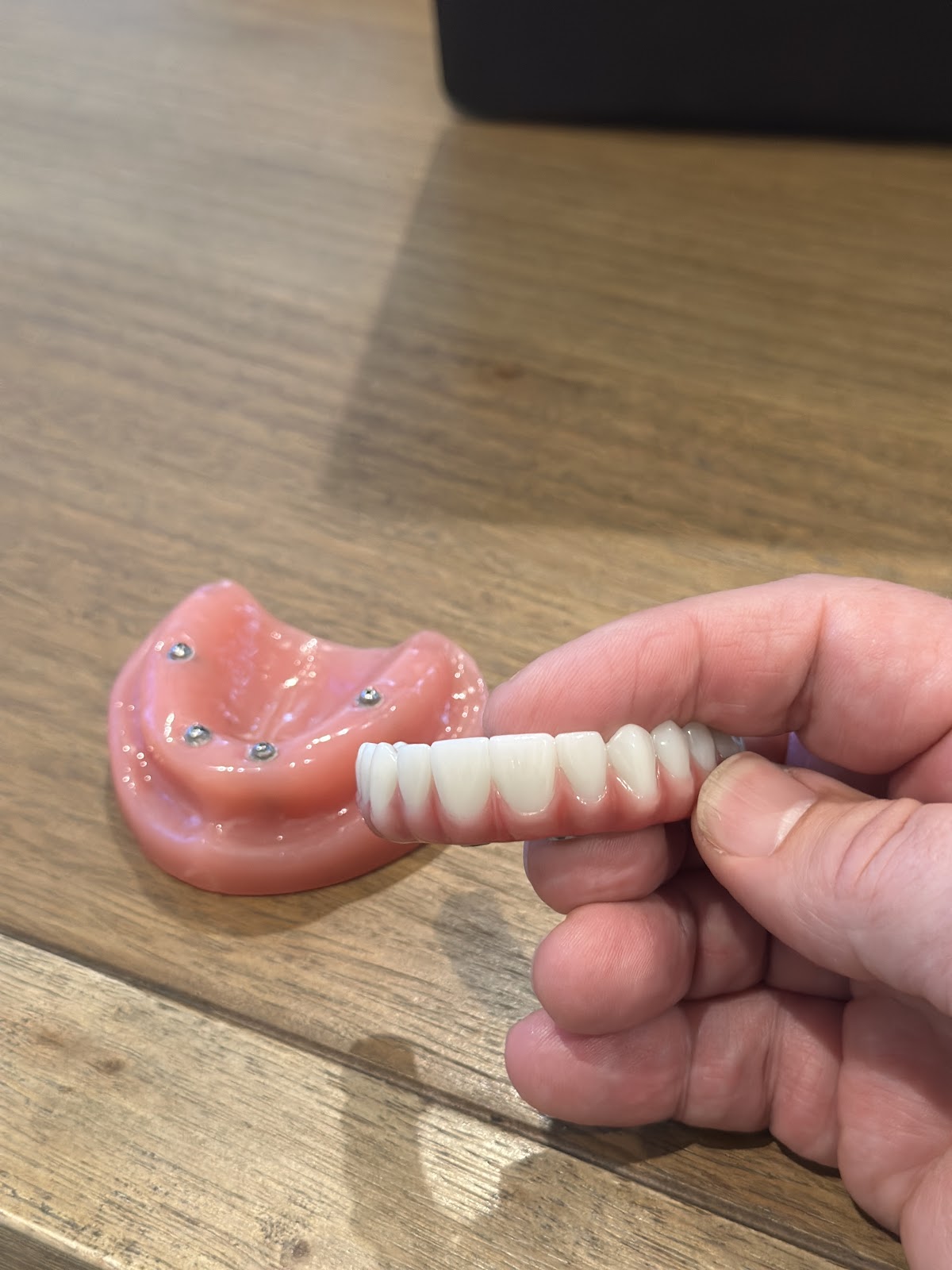 Nuvia Dental Implant Center - Baltimore photo 4