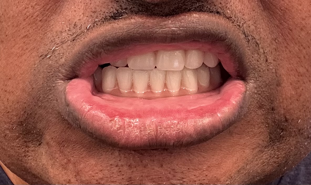 Envision Dental Implant Center photo 5