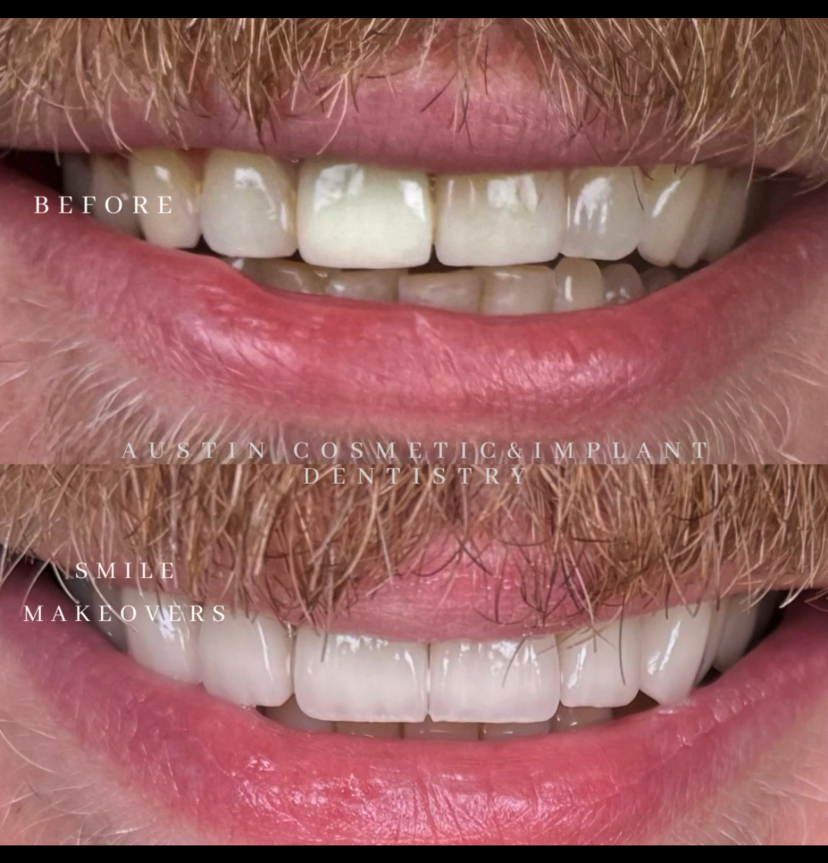 Austin Cosmetic & Implant Dentistry photo 1