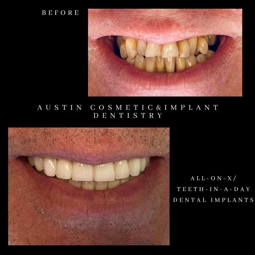 Austin Cosmetic & Implant Dentistry photo 2