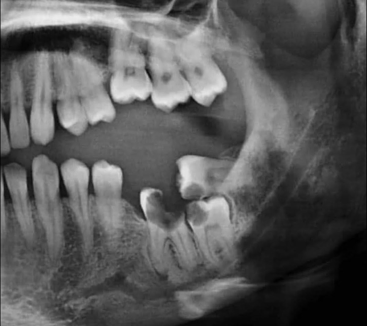 Sky Dental Implant Center photo 6