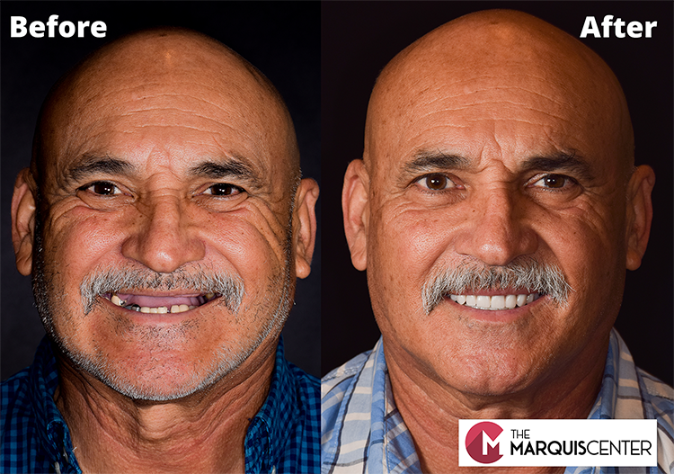 Doctors Implants photo 4