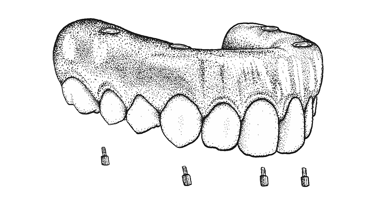 Doctors Implants photo 5