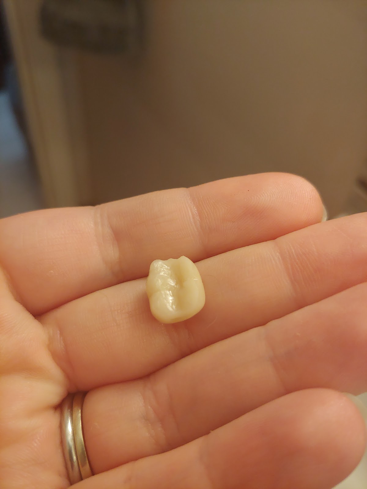 Aspen Dental - Niagara Falls photo 4