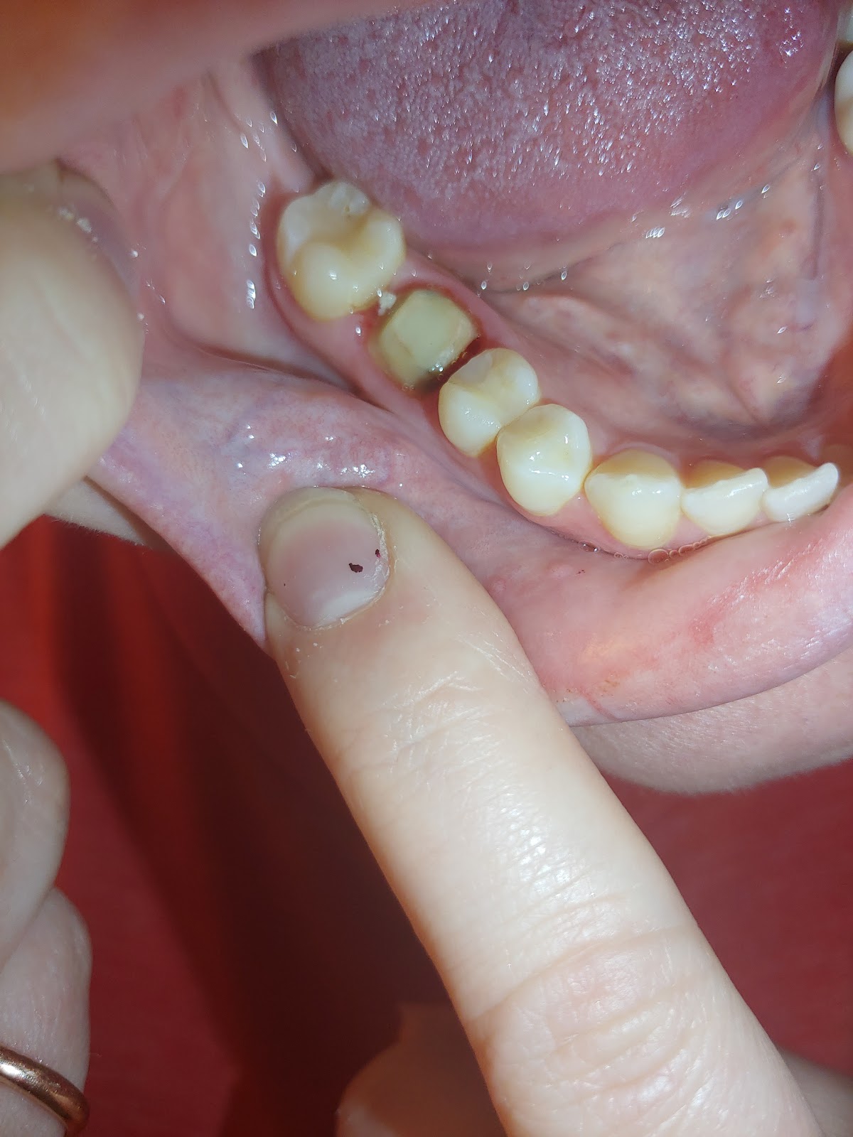 Aspen Dental - Niagara Falls photo 5
