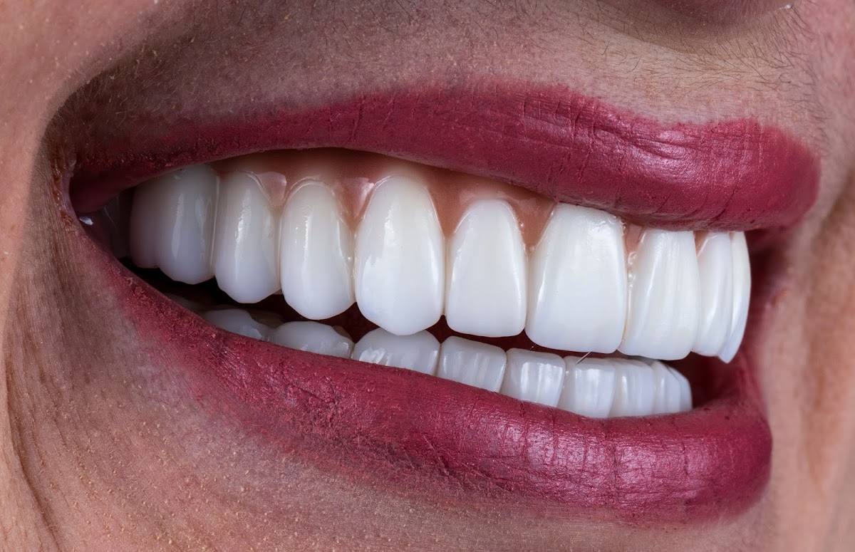 Avant Dental Arts photo 1