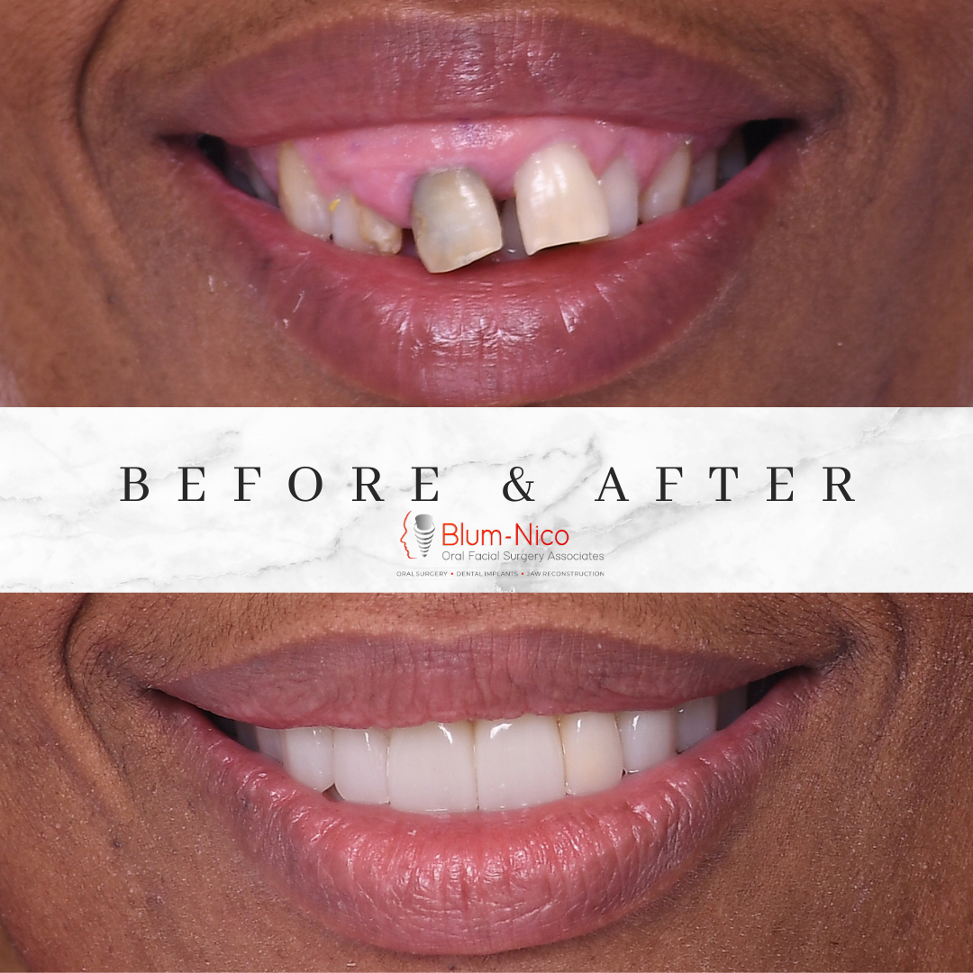 Blum-nico Oral Surgery Associates photo 5